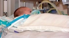 Еще раз про реанимацию. Доброе утро. Фрагмент выпуска от 19.04.2016