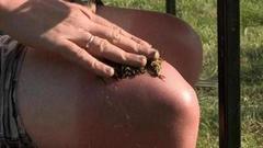 Травяной компресс при солнечном ожоге. Доброе утро. Фрагмент выпуска от 22.07.2016