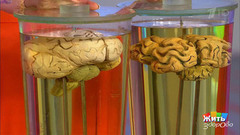 Жиры, от которых не толстеют. Жить здорово! Фрагмент выпуска от 30.03.2017