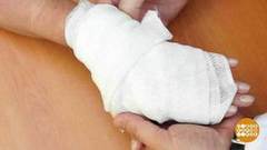 Помощь при ожоге. Доброе утро. Фрагмент выпуска от 25.05.2018