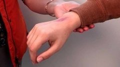 Соль от синяка. Доброе утро. Фрагмент выпуска от 27.10.2015