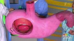 Язва желудка. Как не заработать рак? Жить здорово! Фрагмент выпуска от 23.12.2016