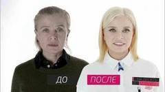 На 10 лет моложе. Выпуск от 03.06.2017