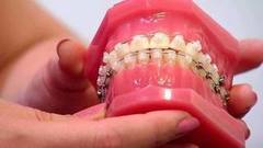 Брекет-системы. Доброе утро. Фрагмент выпуска от 02.11.2016