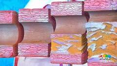 Стенокардия. История Лиона Измайлова. Жить здорово! Фрагмент выпуска от 06.04.2018