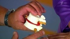 Повелитель боли. Поясничный радикулит. Жить здорово! Фрагмент выпуска от 14.09.2015
