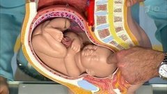 Болезни-лихачи. Вирус Зика. Жить здорово! Фрагмент выпуска от 11.03.2016
