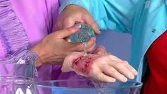 Бешенство. Смертельно опасная инфекция. Жить здорово! Фрагмент выпуска от 26.10.2016