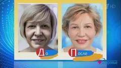 Красота с командой доктора Пухова. Морщины на лице. Здоровье. Фрагмент выпуска от 12.11.2017