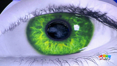 Катаракта и ее лечение. История Ангелины Вовк. Жить здорово! Фрагмент выпуска от 10.05.2018