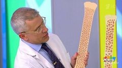 Саммит по остеопорозу. Жить здорово! Фрагмент выпуска от 03.08.2018