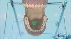 Чем можно заразиться через поцелуи? Здоровье. Фрагмент выпуска от 22.01.2017