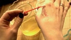 Мед на рану. Доброе утро. Фрагмент выпуска от 02.12.2015