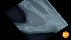 «Чипованные» люди. Доброе утро. Фрагмент выпуска от 19.07.2017