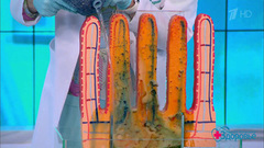 Пересадка микробиоты. Здоровье. Фрагмент выпуска от 01.10.2017