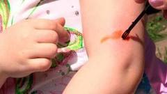 Если вас укусила оса… Доброе утро. Фрагмент выпуска от 03.08.2016