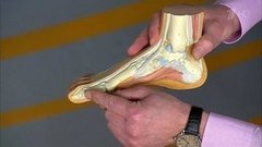 Как подготовить ноги к старости. Жить здорово! Фрагмент выпуска от 11.03.2016