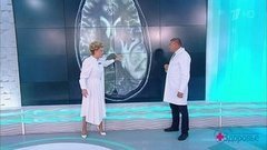 Поздняя беременность и рак мозга — есть ли связь? Здоровье. Фрагмент выпуска от 29.09.2019