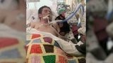 В США шестнадцатилетнего подростка электронные сигареты довели до пересадки легких