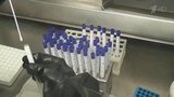 В Армении медики уже работают на пределе возможностей