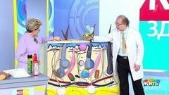 Укус осы. Жить здорово! Фрагмент выпуска от 09.06.2020