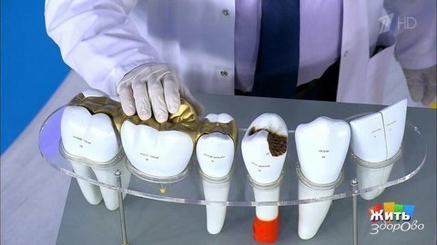 Металлический привкус во рту. Жить здорово! Фрагмент выпуска от 25.09.2020