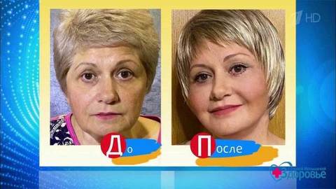 Шьем лицо к Новому году. Уникальная технология омоложения. Здоровье. Фрагмент