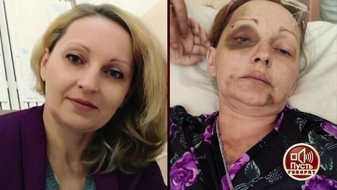 Школьную учительницу едва не убил муж. Пусть говорят
