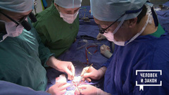 Один день из жизни Бакулевского центра. Человек и закон. Фрагмент