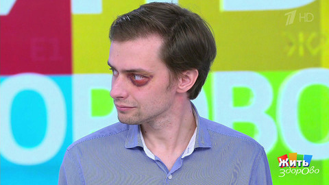 Синяк или перелом? Жить здорово! Фрагмент
