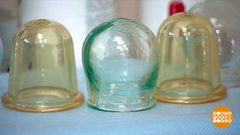 Банки и горчичники: уже не модно? Доброе утро. Фрагмент