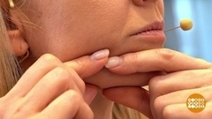 Избавляемся от брылей. Доброе утро. Фрагмент