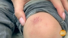 Ссадина — это не пустяк. Доброе утро. Фрагмент