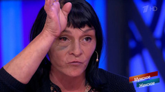 «Муж хотел так пошутить». Героиня объяснила, откуда у нее синяк. Мужское / Женское. Фрагмент