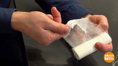 Ожог бенгальским огнем: первая помощь. Доброе утро. Фрагмент