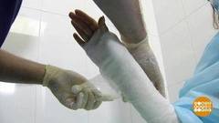 Поскользнулся, упал, очнулся — гипс... Доброе утро. Фрагмент