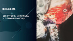 Опущение уголка рта и нарушение речи. Как распознать инсульт. Баден-Баден. Фрагмент