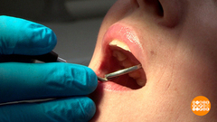 Враги зубной эмали: и картошка тоже? Доброе утро. Фрагмент