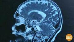 Болезнь Альцгеймера: это важно знать! Доброе утро. Суббота. Фрагмент