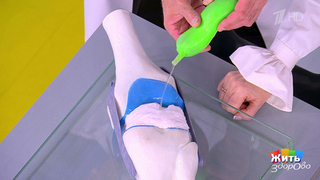 Причины боли в суставах, о которых вы не подозревали. Жить здорово! Фрагмент