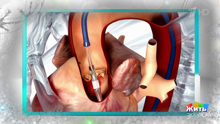 Галоп в сердце: когда ритм говорит о проблеме. Жить здорово! Фрагмент