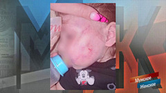 «Ребенка методично убивали». Мать с отчимом истязались над годовалой девочкой. Мужское / Женское. Фрагмент