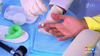 Крио против бородавок. Жить здорово! Фрагмент