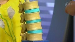 Почему болит спина? Жить здорово! Фрагмент выпуска от 27.05.2016