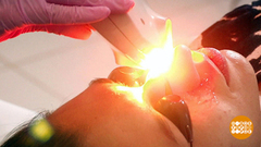 Как бороться с куперозом. Доброе утро. Фрагмент выпуска от 03.12.2018