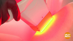 Вся правда о лазерной эпиляции. Доброе утро. Фрагмент выпуска от 16.04.2019