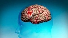 Лето. Жара. Инсульт. Доброе утро. Фрагмент выпуска от 09.07.2015