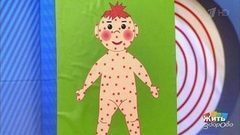 Летние болезни у детей. Жить здорово! Фрагмент выпуска от 01.08.2017