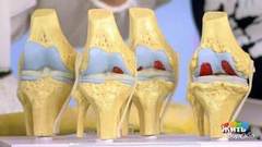 Боль в суставах. Жить здорово! Фрагмент выпуска от 12.09.2018