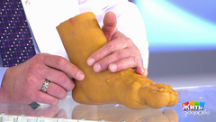 Совет за минуту: если подвернул ногу. Жить здорово! Фрагмент выпуска от 22.10.2018